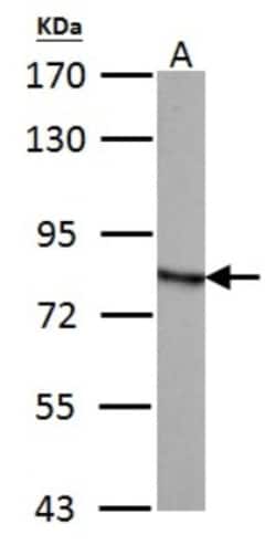 HADHA Antibody, Novus Biologicals 0.1mL; Unlabeled:Antibodies, Polyclonal