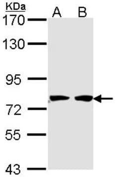 HADHA Antibody, Novus Biologicals 0.1mL; Unlabeled:Antibodies, Polyclonal
