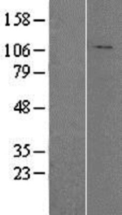 Novus Biologicals&trade;&nbsp;HADHA Overexpression Lysate