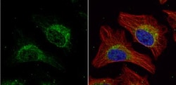 HADHA Antibody, Novus Biologicals 0.1mL; Unlabeled:Antibodies, Polyclonal