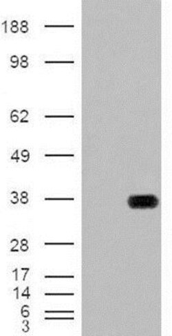 HADH Antibody, Novus Biologicals 0.1mg; Unlabeled:Antibodies, Polyclonal