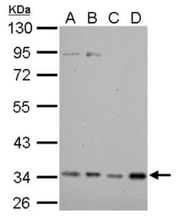HADH Antibody, Novus Biologicals 0.1mL; Unlabeled:Antibodies, Polyclonal