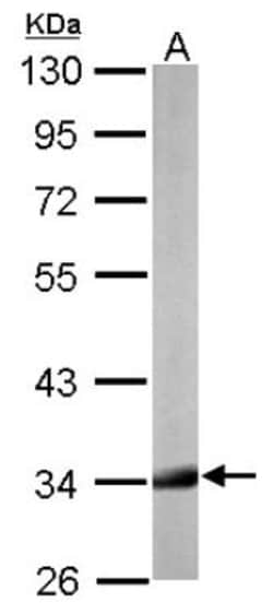 HADH Antibody, Novus Biologicals 0.1mL; Unlabeled:Antibodies, Polyclonal