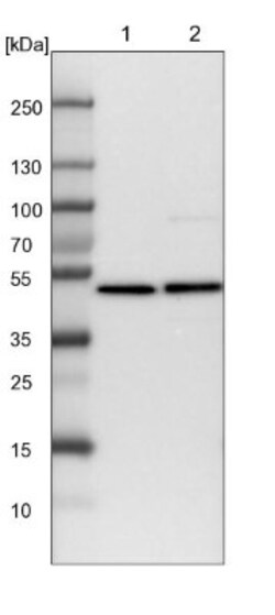 HADHB Antibody, Novus Biologicals 0.1mL; Unlabeled:Antibodies, Polyclonal