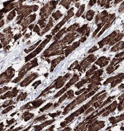 HADHB Antibody, Novus Biologicals 0.1mL; Unlabeled:Antibodies, Polyclonal