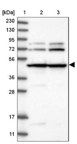 HADHB Antibody, Novus Biologicals 0.1mL; Unlabeled:Antibodies, Polyclonal