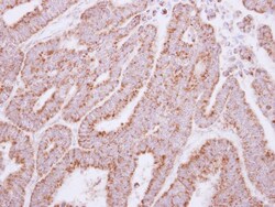 Glyoxalase II/HAGH Antibody, Novus Biologicals 0.1mL; Unlabeled:Antibodies,