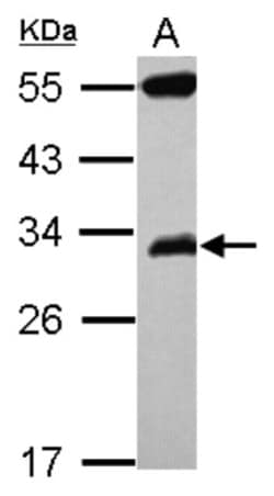 Glyoxalase II/HAGH Antibody, Novus Biologicals 0.1mL; Unlabeled:Antibodies,