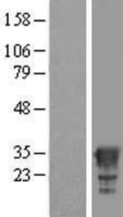 Novus Biologicals&trade;&nbsp;HAGHL Overexpression Lysate