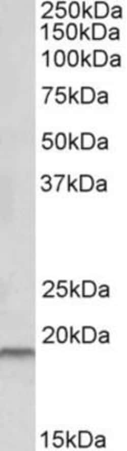 HAI-2/SPINT2 Antibody, Novus Biologicals 0.1mg; Unlabeled:Antibodies, Polyclonal