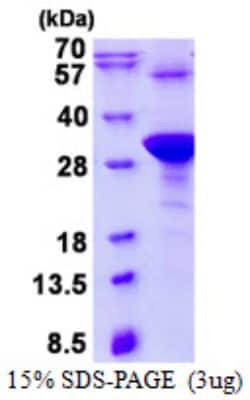 Novus Biologicals&trade;&nbsp;Recombinant Human HAND1 His Protein