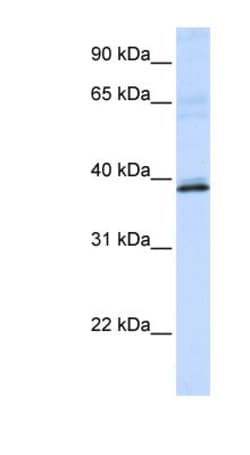 HAO2 Antibody, Novus Biologicals:Antibodies:Primary Antibodies