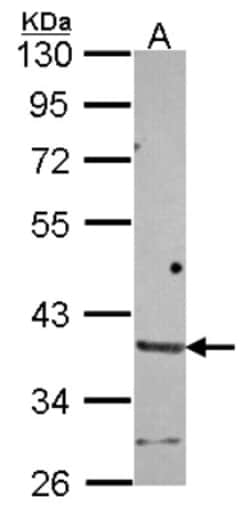 HAPLN2 Antibody, Novus Biologicals 0.1mL; Unlabeled:Antibodies, Polyclonal