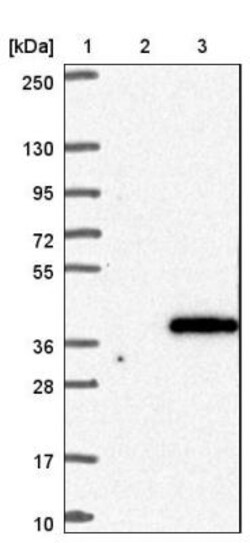 HAPLN2 Antibody, Novus Biologicals 0.1mL; Unlabeled:Antibodies, Polyclonal