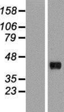 Novus Biologicals&trade;&nbsp;HAPLN3 Overexpression Lysate