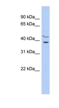 HARBI1 Antibody, Novus Biologicals 100&mu;L; Unlabeled:Antibodies, Polyclonal