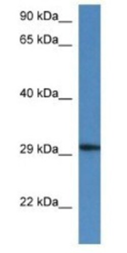 HARBI1 Antibody, Novus Biologicals 20&mu;L; Unlabeled:Antibodies, Polyclonal