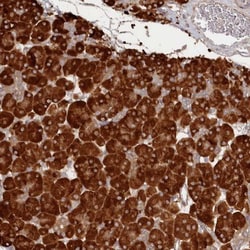 HARBI1 Antibody, Novus Biologicals 0.1mL; Unlabeled:Antibodies, Polyclonal