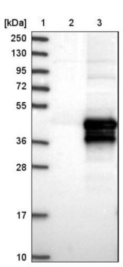 HARBI1 Antibody, Novus Biologicals 0.1mL; Unlabeled:Antibodies, Polyclonal