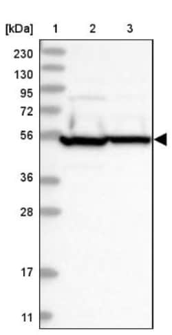 HARS Antibody, Novus Biologicals:Antibodies:Primary Antibodies