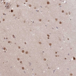 HAUS3 Antibody, Novus Biologicals:Antibodies:Primary Antibodies