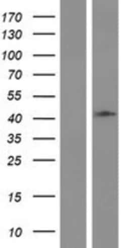 Novus Biologicals&trade;&nbsp;HAUS4 Overexpression Lysate