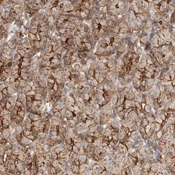 HAUS4 Antibody, Novus Biologicals 0.1mL; Unlabeled:Antibodies, Polyclonal