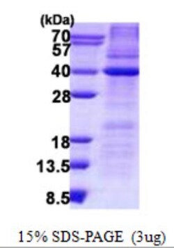 Novus Biologicals&trade;&nbsp;Recombinant Human HAX-1 His Protein