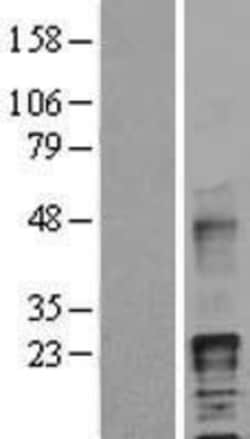 Novus Biologicals&trade;&nbsp;HB-EGF Overexpression Lysate