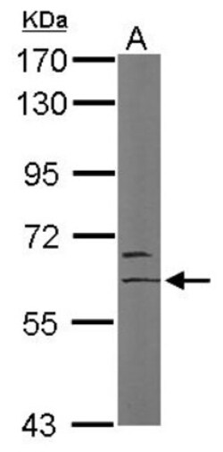 HBO1 Antibody, Novus Biologicals 0.1mL; Unlabeled:Antibodies, Polyclonal