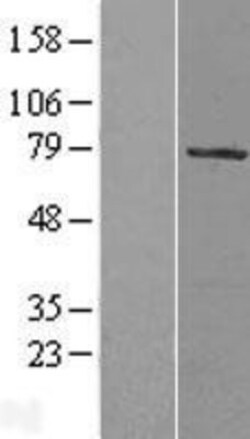 Novus Biologicals&trade;&nbsp;HBO1 Overexpression Lysate