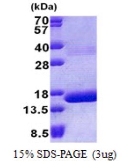Novus Biologicals&trade;&nbsp;Recombinant Human HBQ1 His Protein
