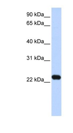 HBXIP Antibody, Novus Biologicals 0.05mg; Unlabeled:Antibodies, Polyclonal