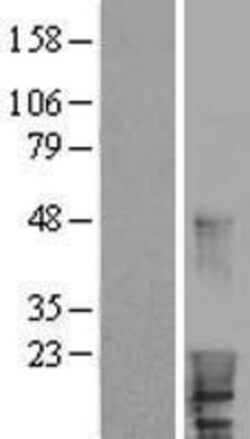 Novus Biologicals&trade;&nbsp;HBXIP Overexpression Lysate