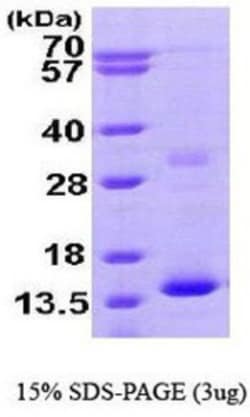 Novus Biologicals&trade;&nbsp;Recombinant Human Hemoglobin zeta His Protein