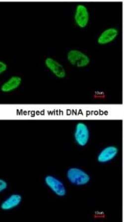 HCA59 Antibody, Novus Biologicals 0.1mg; Unlabeled:Antibodies, Polyclonal