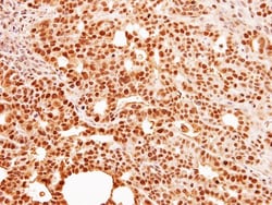 HCA59 Antibody, Novus Biologicals 0.1mg; Unlabeled:Antibodies, Polyclonal