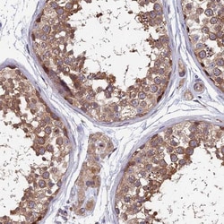 HCAP-G Antibody, Novus Biologicals:Antibodies:Primary Antibodies