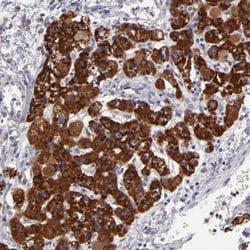 HCCS Antibody, Novus Biologicals:Antibodies:Primary Antibodies