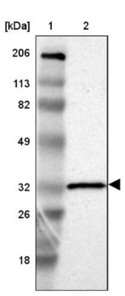 HCCS Antibody, Novus Biologicals 25 &mu;L; Unlabeled:Antibodies, Polyclonal