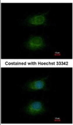 Host Cell Factor 1/HCFC1 Antibody, Novus Biologicals 0.1mL; Unlabeled:Antibodies,
