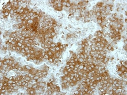 Host Cell Factor 1/HCFC1 Antibody, Novus Biologicals 0.1mL; Unlabeled:Antibodies,