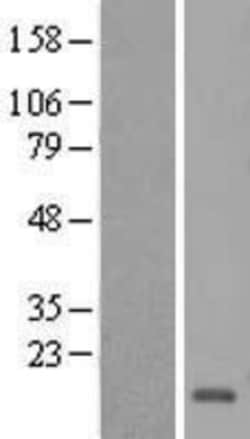 Novus Biologicals&trade;&nbsp;HCFC1R1 Overexpression Lysate