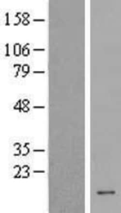 Novus Biologicals&trade;&nbsp;HCFC1R1 Overexpression Lysate