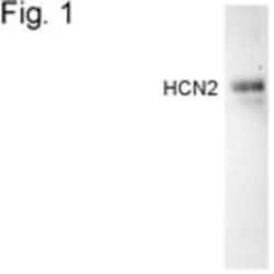 HCN2 Antibody, Novus Biologicals 0.025 mg, Unconjugated:Antibodies, Polyclonal