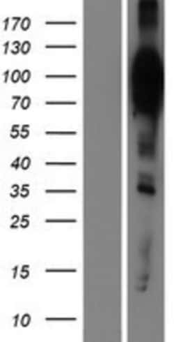Novus Biologicals&trade;&nbsp;HCN2 Overexpression Lysate