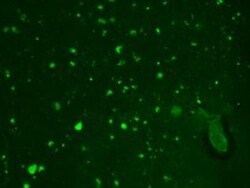 HCN2 Antibody (S71-37), Novus Biologicals 0.1mg; Unlabeled:Antibodies,