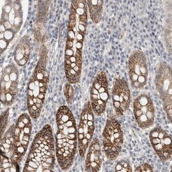 HCN3 Antibody, Novus Biologicals:Anticuerpos:Anticuerpos primarios