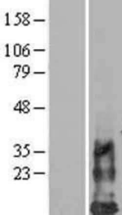 Novus Biologicals&trade;&nbsp;DAP10/HCST Overexpression Lysate