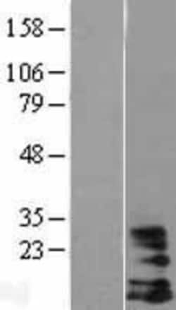 Novus Biologicals&trade;&nbsp;DAP10/HCST Overexpression Lysate